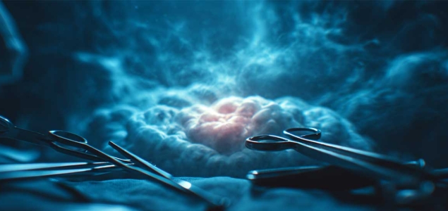 Отделениие онкогинекологии